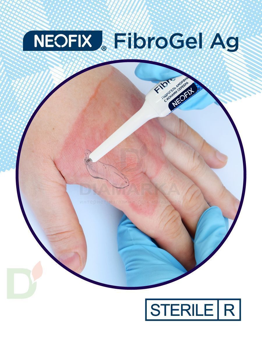 Гидрогель антимикробный NEOFIX FibroGel Fg с ионами серебра 15г в Челябинске